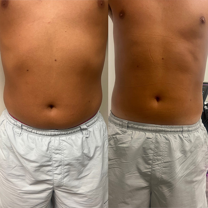 PHYSIQ 360 Before/After