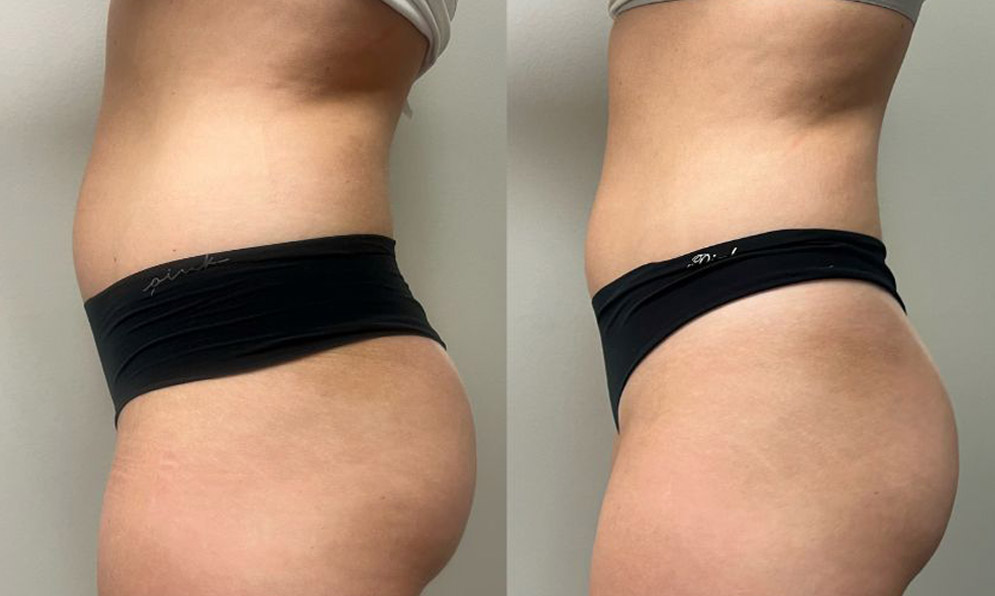PHYSIQ 360 B&A Template – 2
