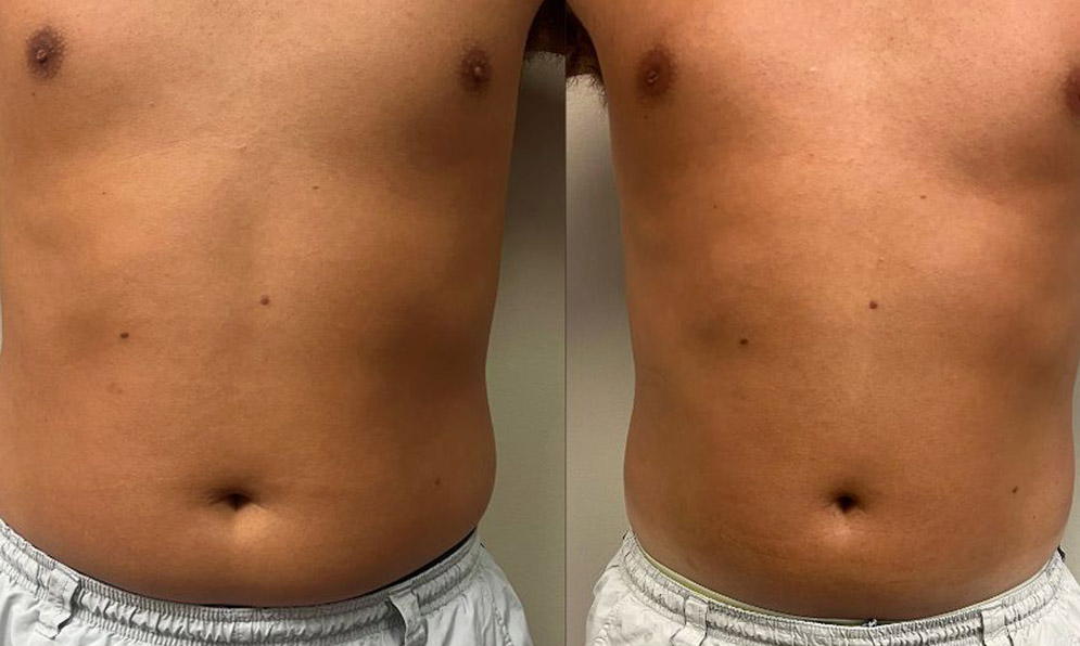 PHYSIQ 360 B&A Template – 2