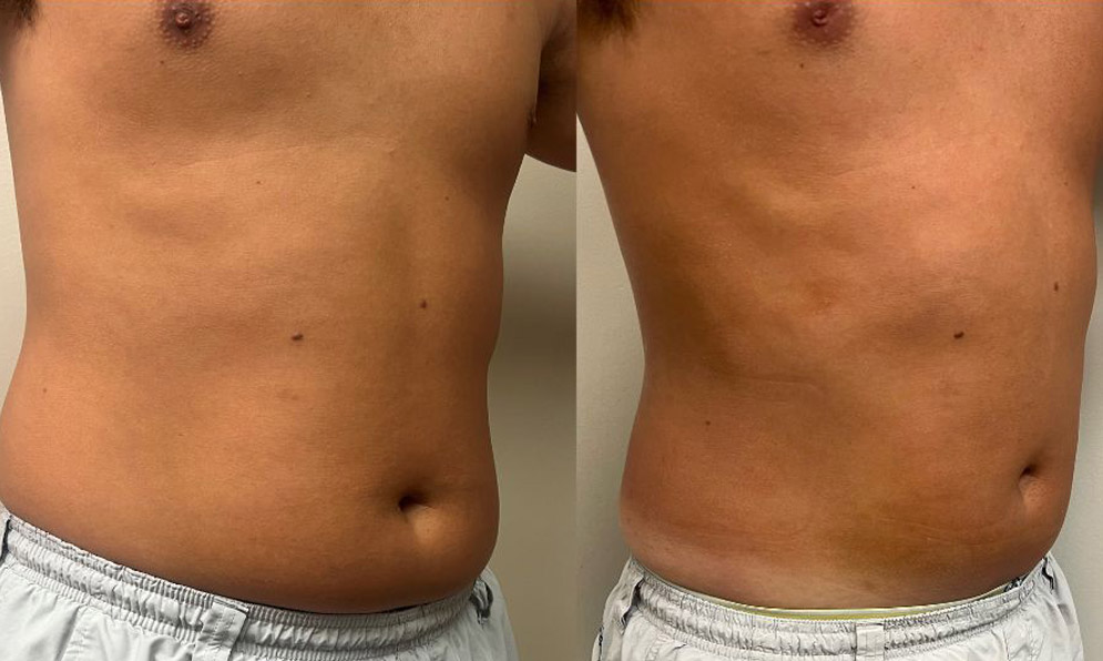 PHYSIQ 360 B&A Template – 2